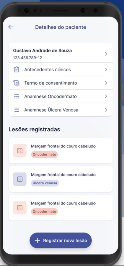 DermAlert - Sistema Inteligente de Detecção de Lesões Dermatológicas